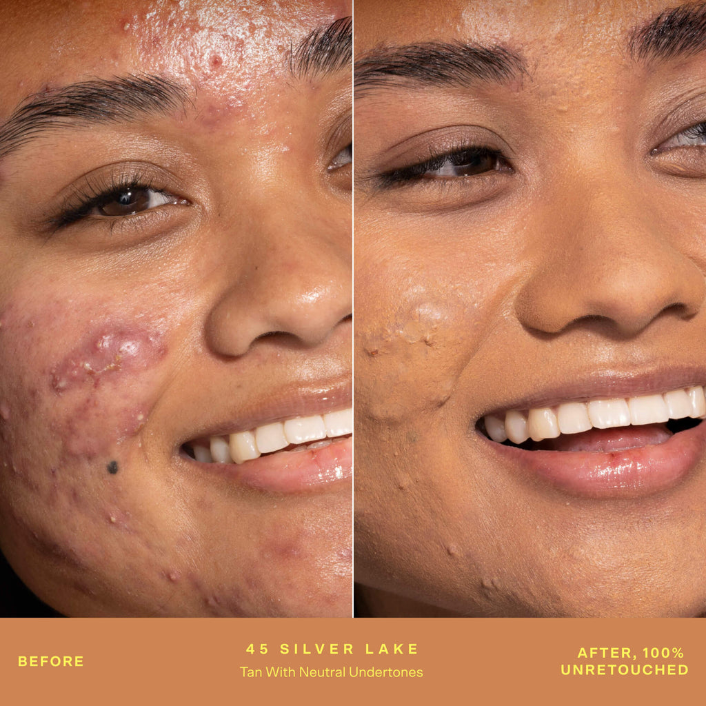 SunnyDays™ Skin-Evening tinted SPF 30