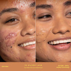 SunnyDays™ Skin-Evening tinted SPF 30