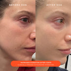 SOS Barrier-Supporting recovery cream