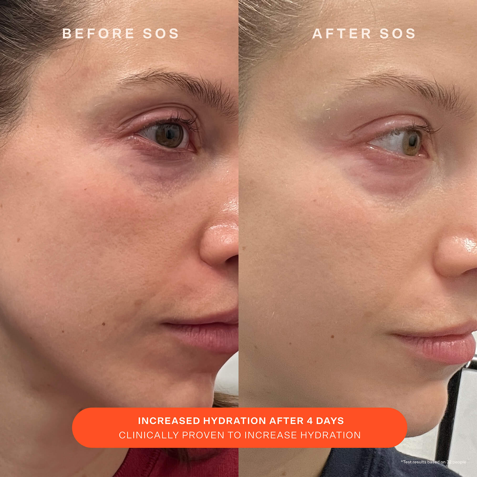 SOS Barrier-Supporting recovery cream