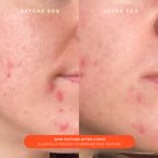 SOS Barrier-Supporting recovery cream