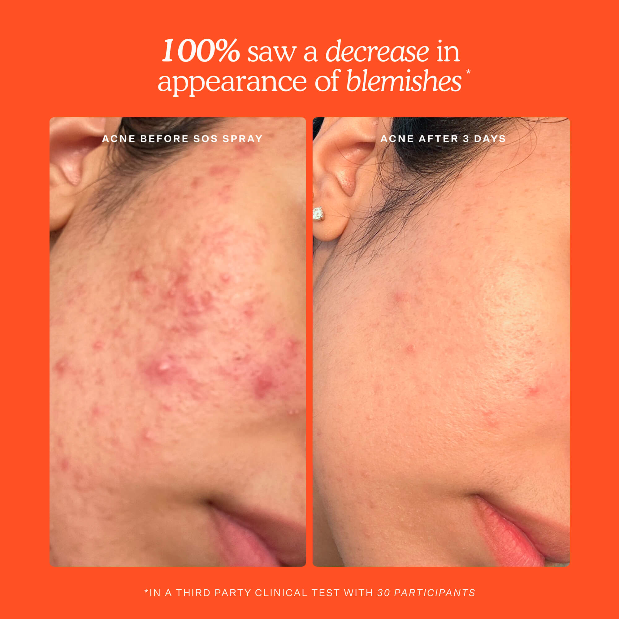 SOS 3-Step Routine-Ready skincare set