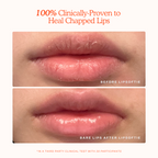 LipSoftie® Nourishing lip treatment
