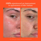 SOS 3-Step Routine-Ready skincare set