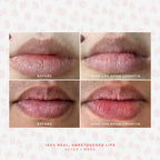 SOS LipSoftie® Nourishing lip treatment
