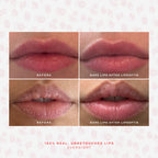 SOS LipSoftie® Nourishing lip treatment