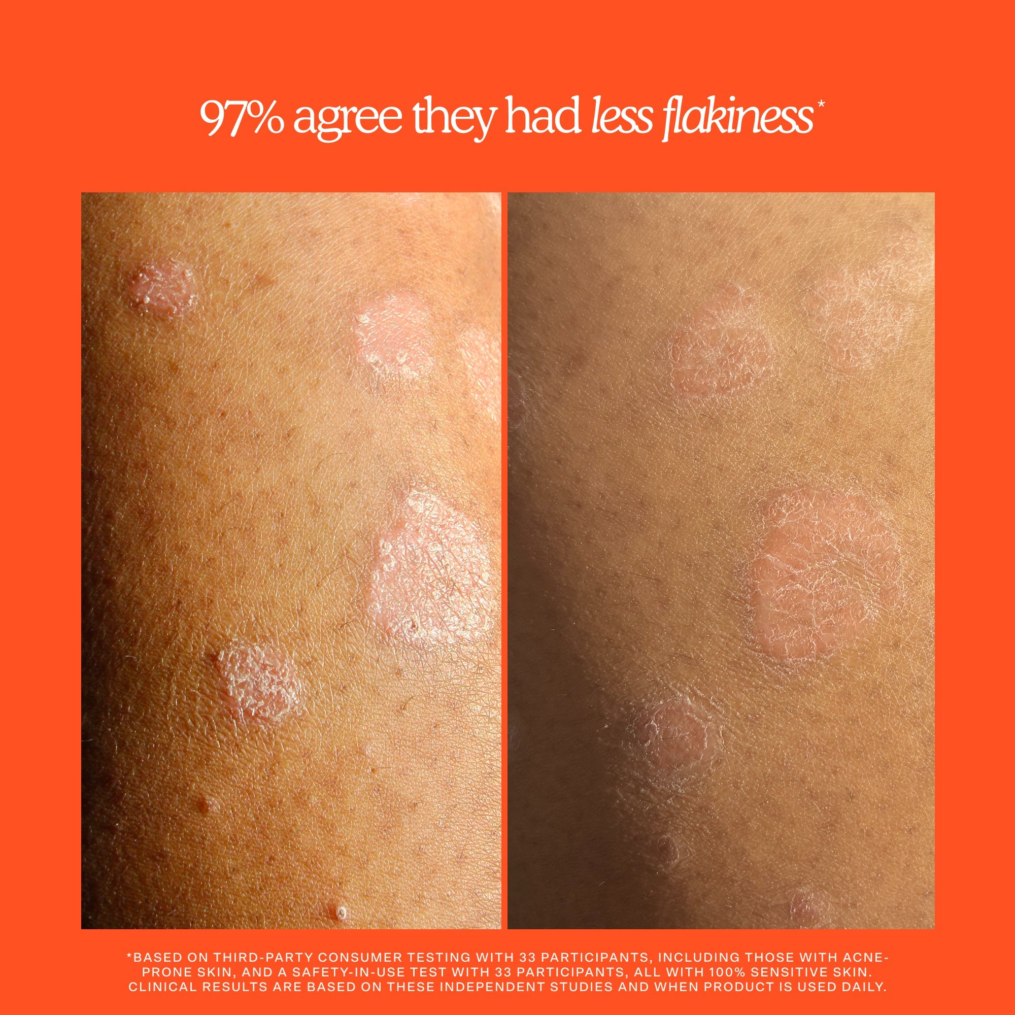 SOS Rescue + Relief Soothing body wash treatment