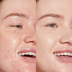 Swipe Hydrating serum concealer®